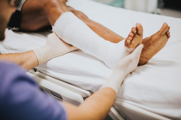 Fractures and Broken Bones